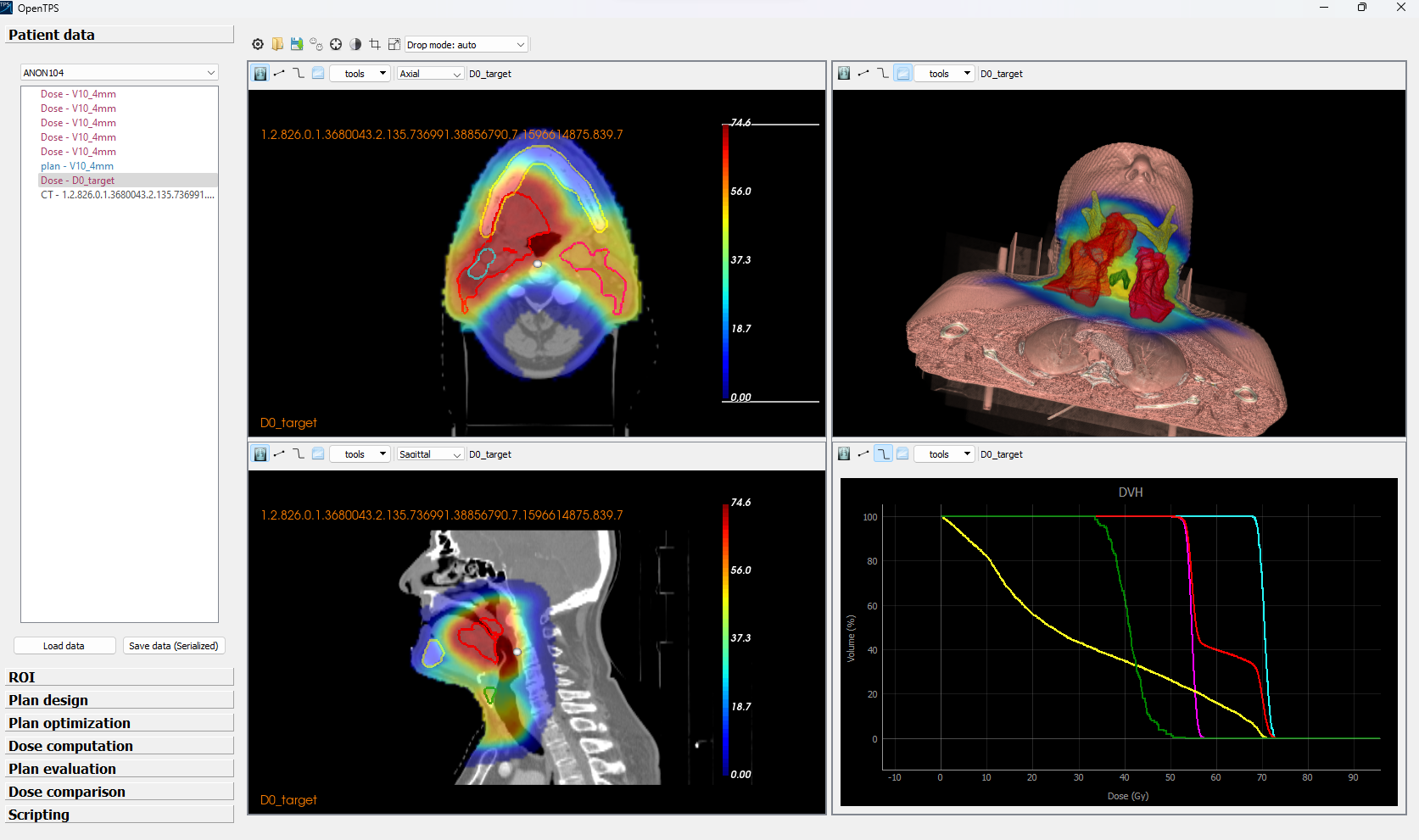 Radiation Treatment Planning Technologies